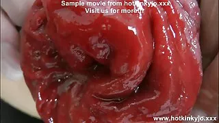 জেসিকা speculum সঙ্গ ...